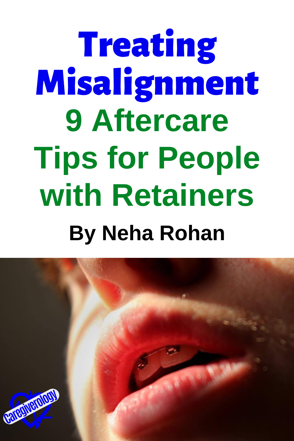 misalignment retainers pin